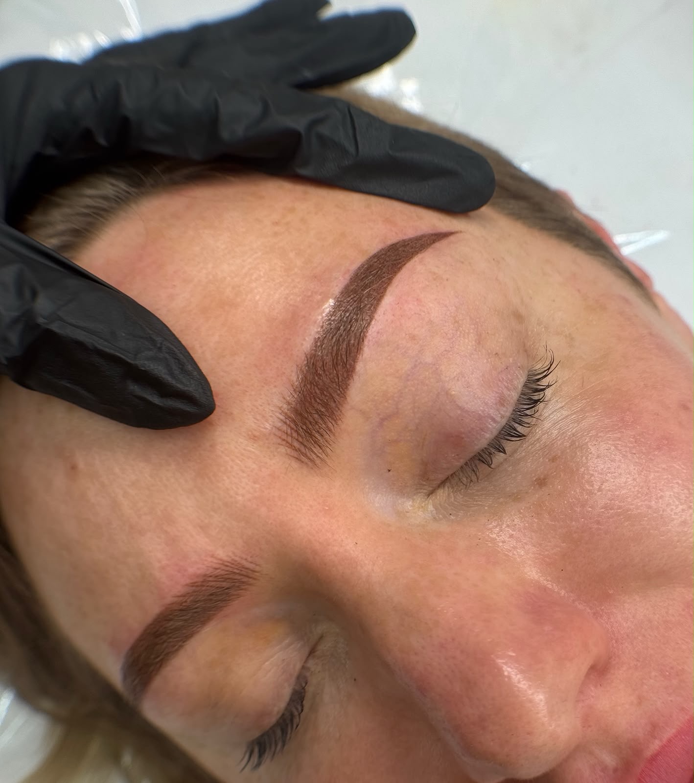 Healed combination brows, close up