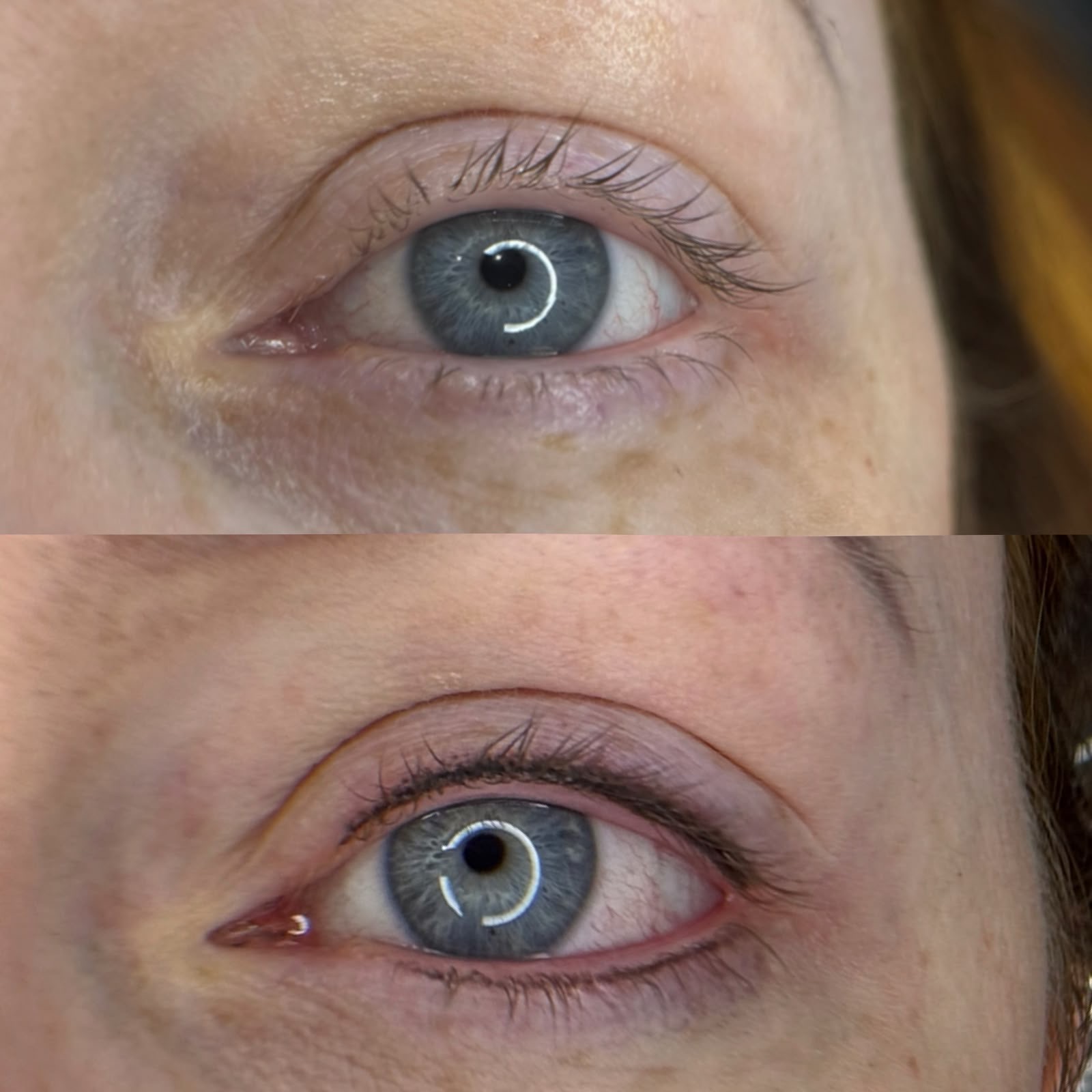Lash line enhancement, before and after