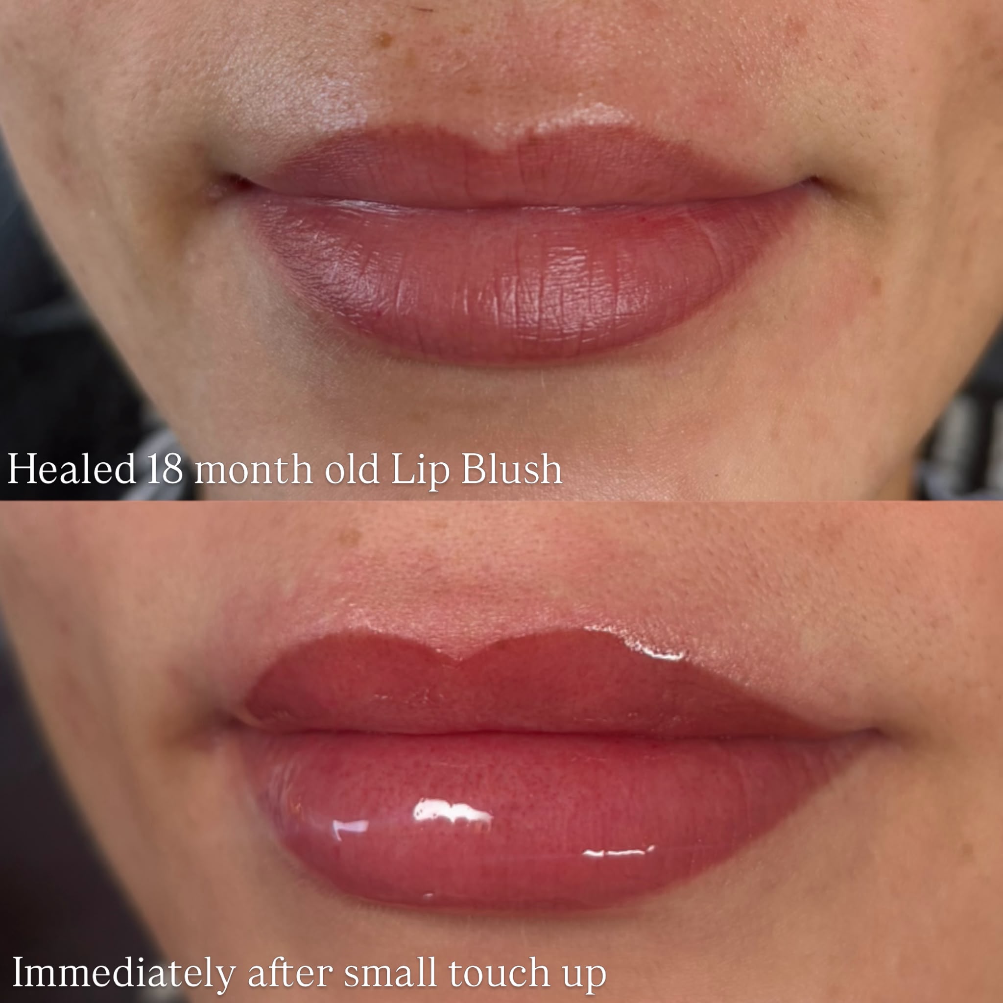 Lip blush healed at 18 months, before and after a small top-up
