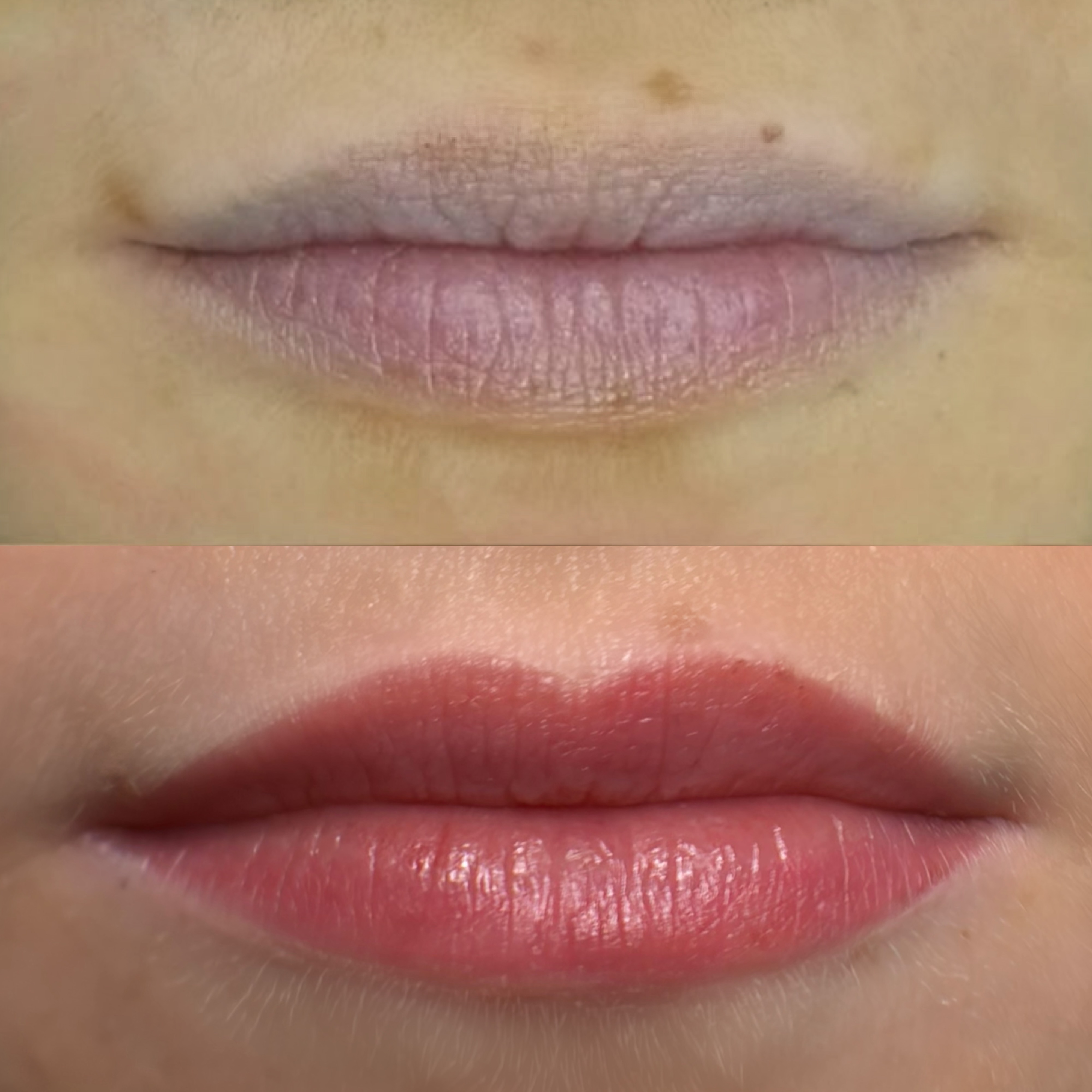 Before and after, cool-toned lips brought to a warmer, more even colour