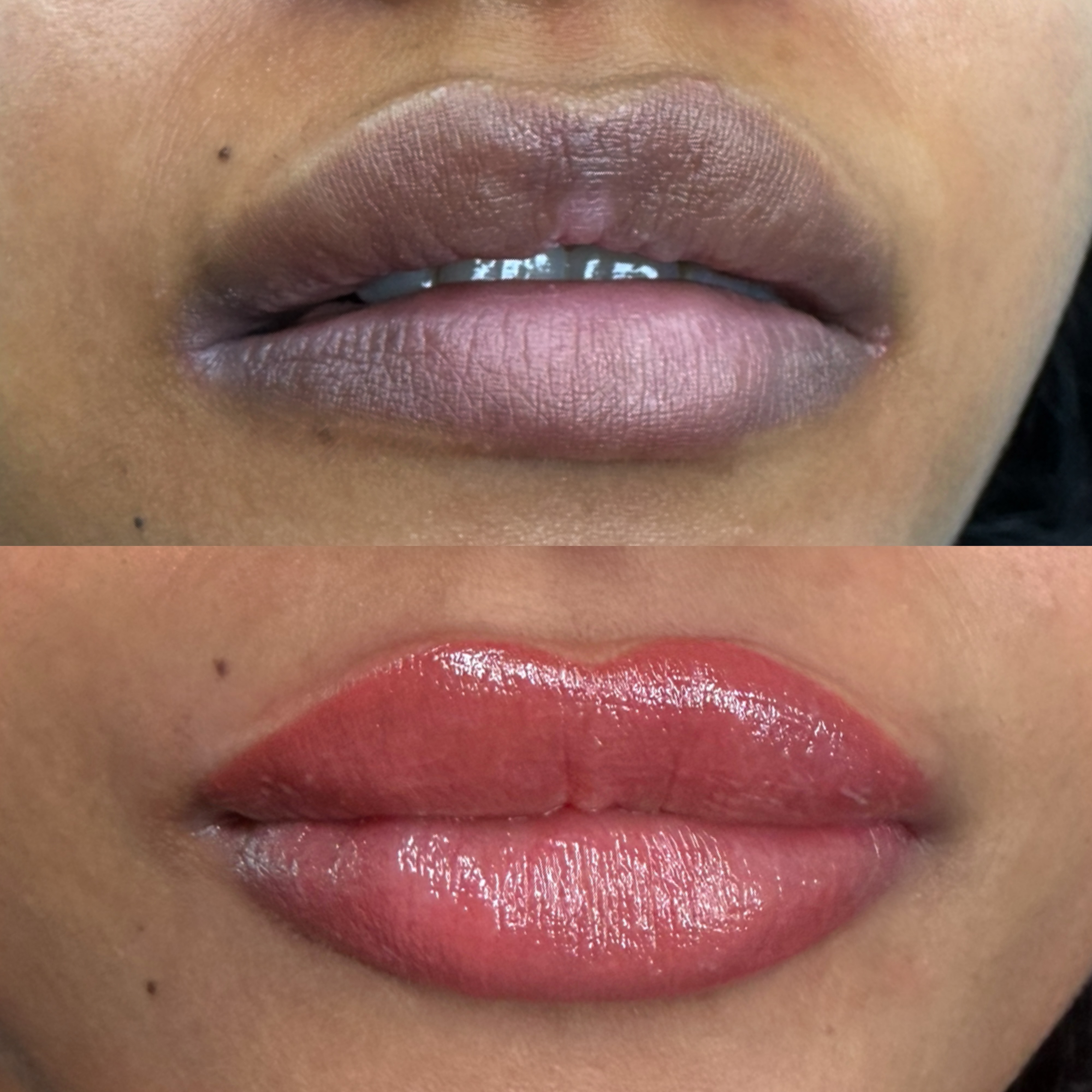 Lip neutralisation brightening naturally darker lips to an even tone